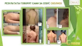 СЕАНС БИОЭНЕРГОМАССАЖА FOHOW.